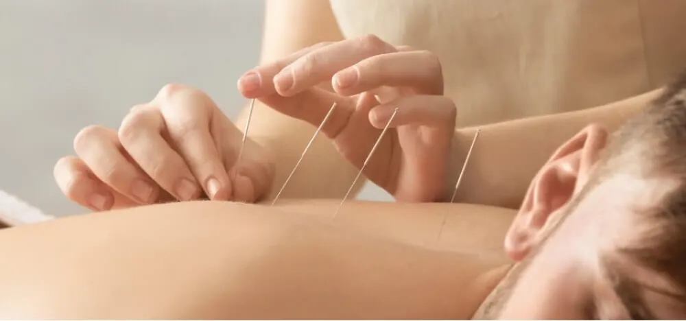 benefits of weekly acupuncture	