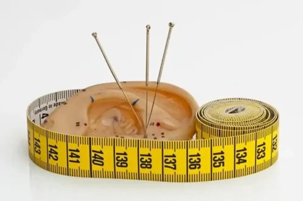 acupuncture good for weight loss