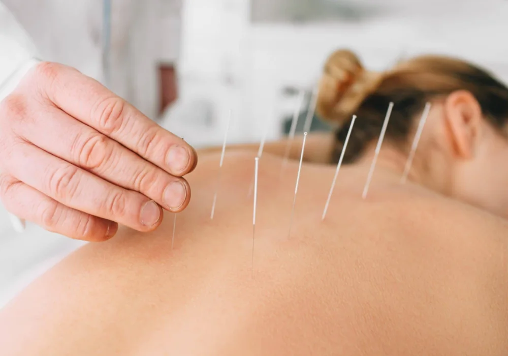 health benefits of acupuncture treatment