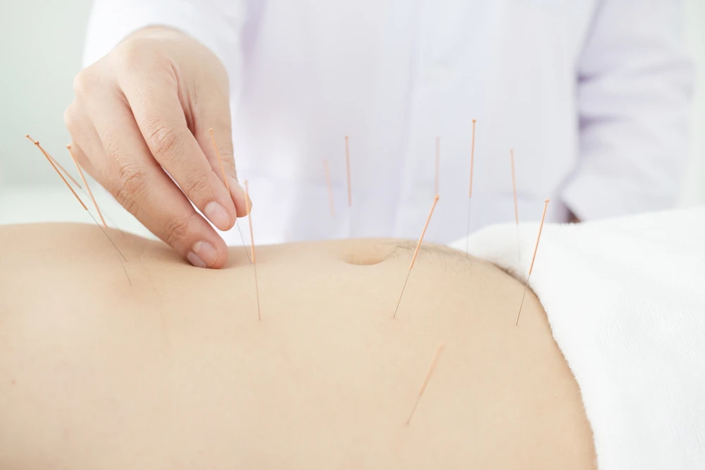 acupuncture points for weight loss side effects