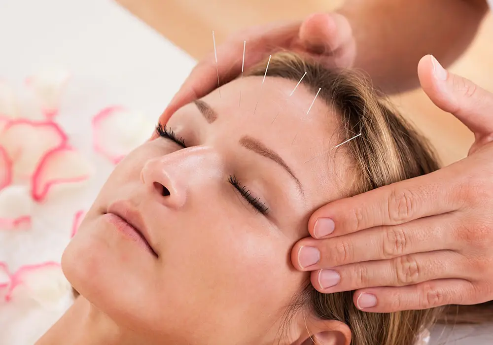 Acupuncture in head benefits