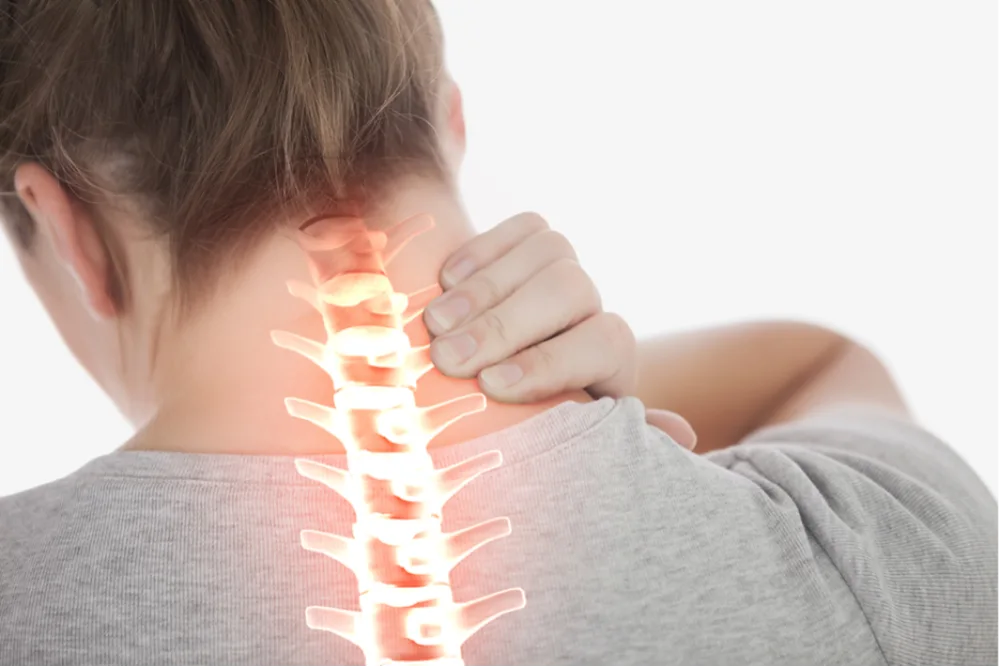 physiotherapy management of neck pain