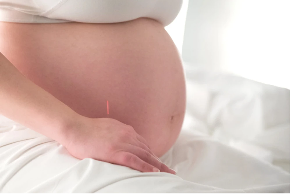 Acupuncture Benefits and Safety During Pregnancy