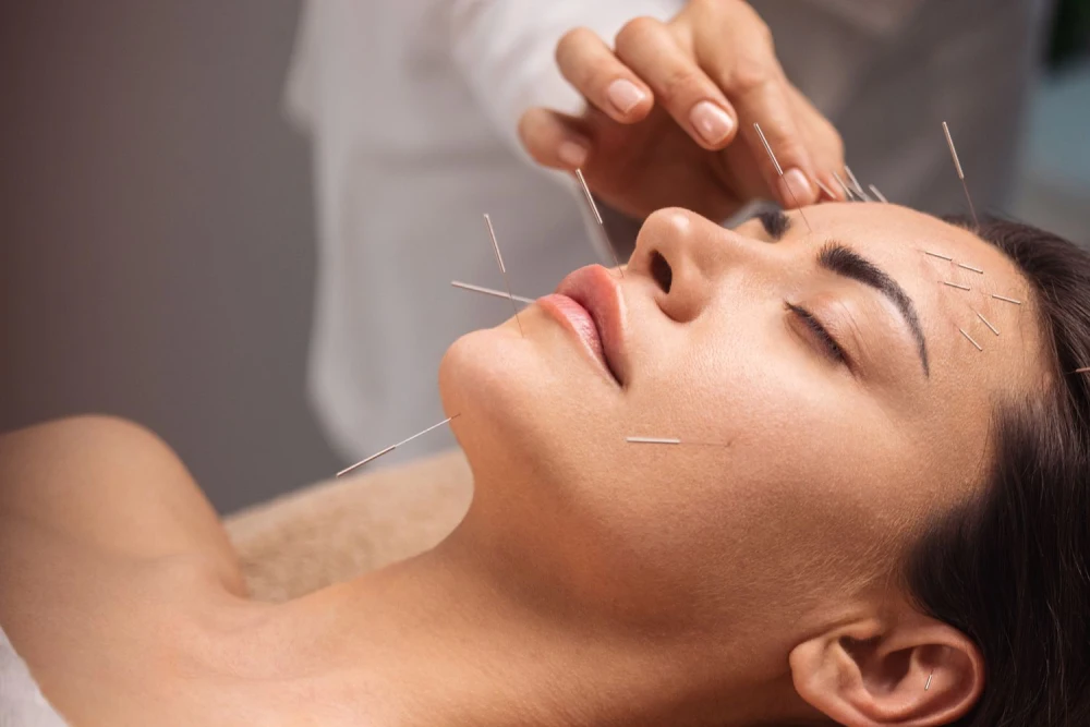 acupuncture for face benefits